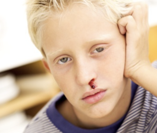 코피가 자주나는 이유 19