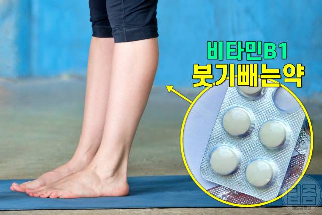 이뇨제 붓기빼는약 오래 먹으면 복용 부작용 비타민B1 부족