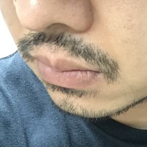 파나소닉 바디 트리머 ER-GK60 3mm 캡 사용 후 수염 정리 모습 – 균일한 길이 커팅 결과