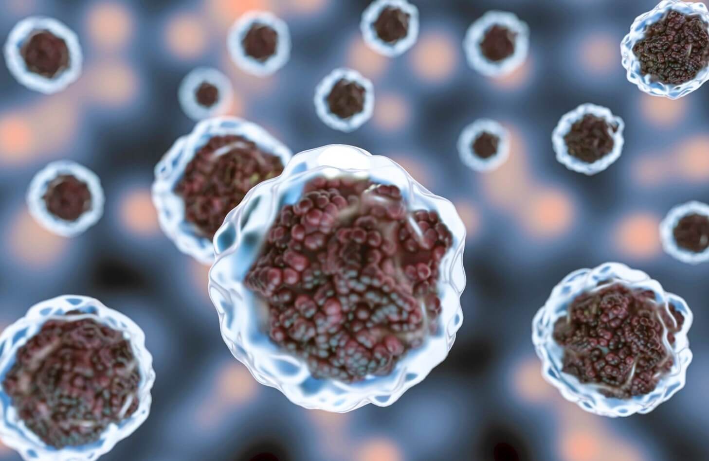 피부 암 세포들