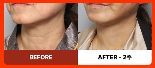 목거상술, 목거상후기