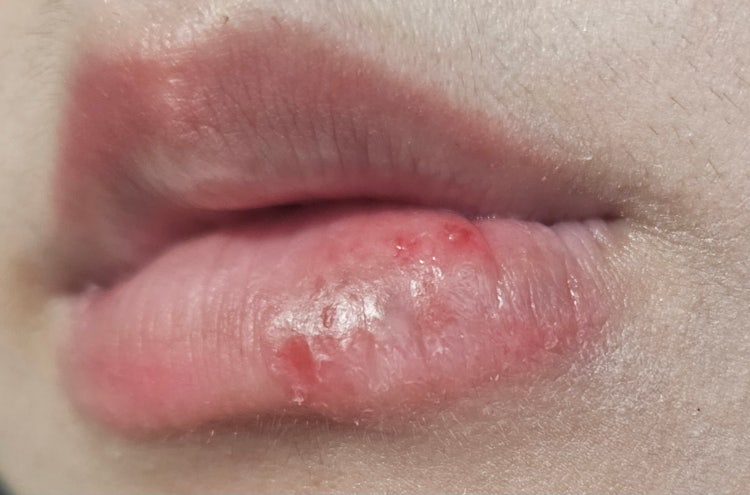 "구순암" 관련 이미지