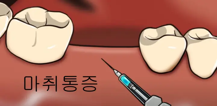잇몸-마취주사-사진