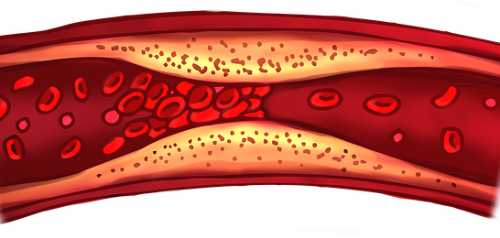 콜레스테롤 낮추는 음식