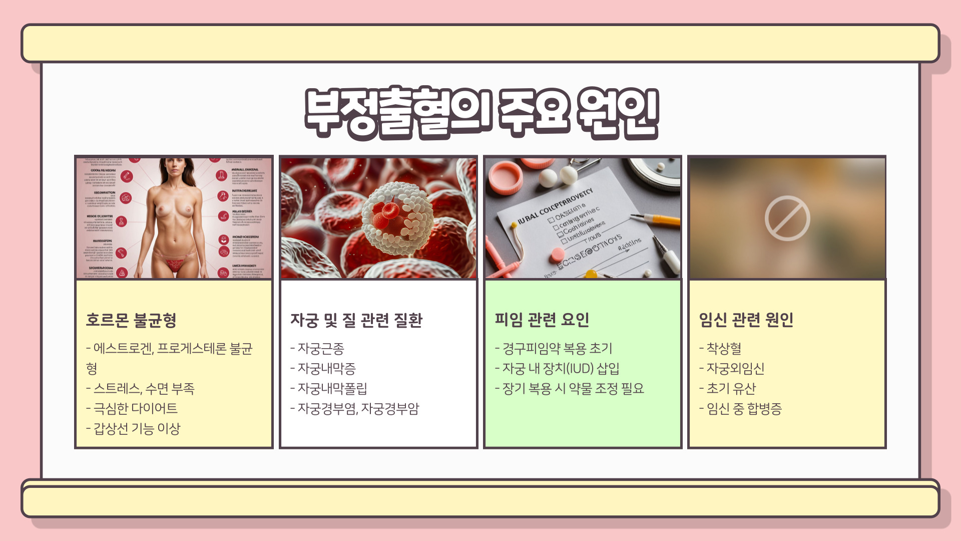 부정출혈 원인과 치료