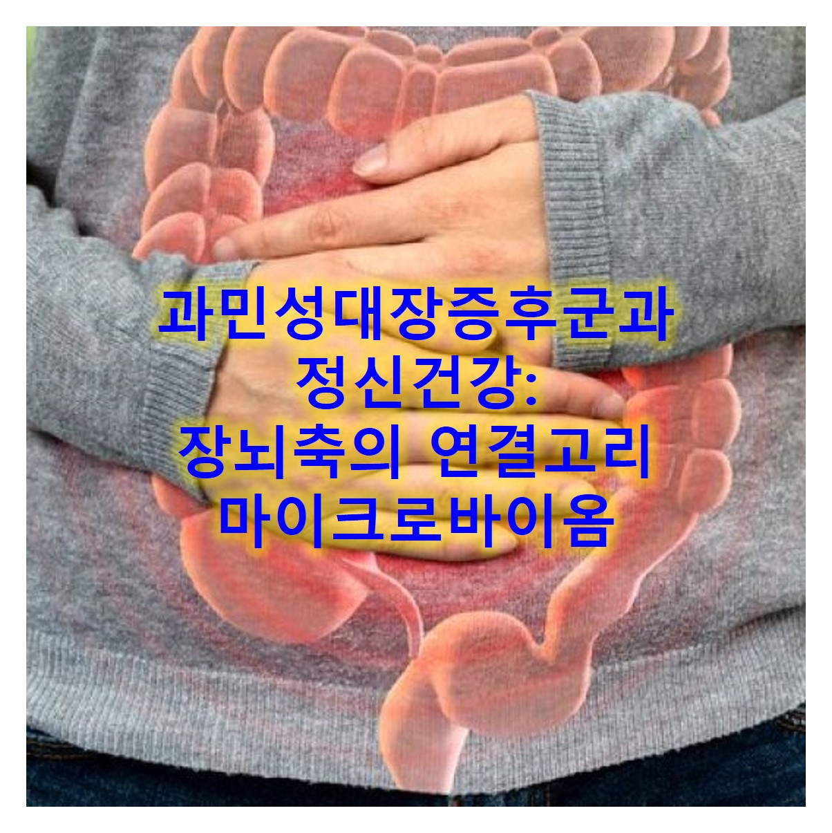 과민성대장증후군