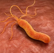 헬리코박터균 원인