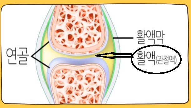 무릎에 물이 찼을때 원인