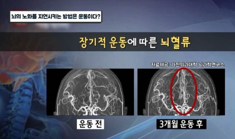 정기적 운동과 뇌건강