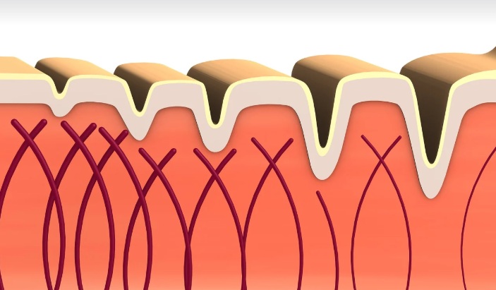피부속 콜라겐에 모습