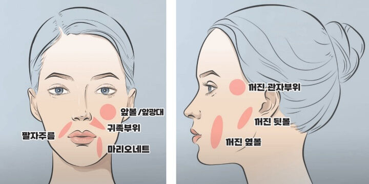 쥬베룩볼륨 효과가 좋은 부위