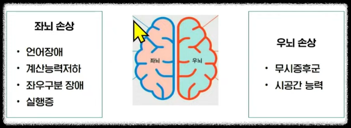 좌&middot;우 뇌손상에 따라 생기는 장애유형