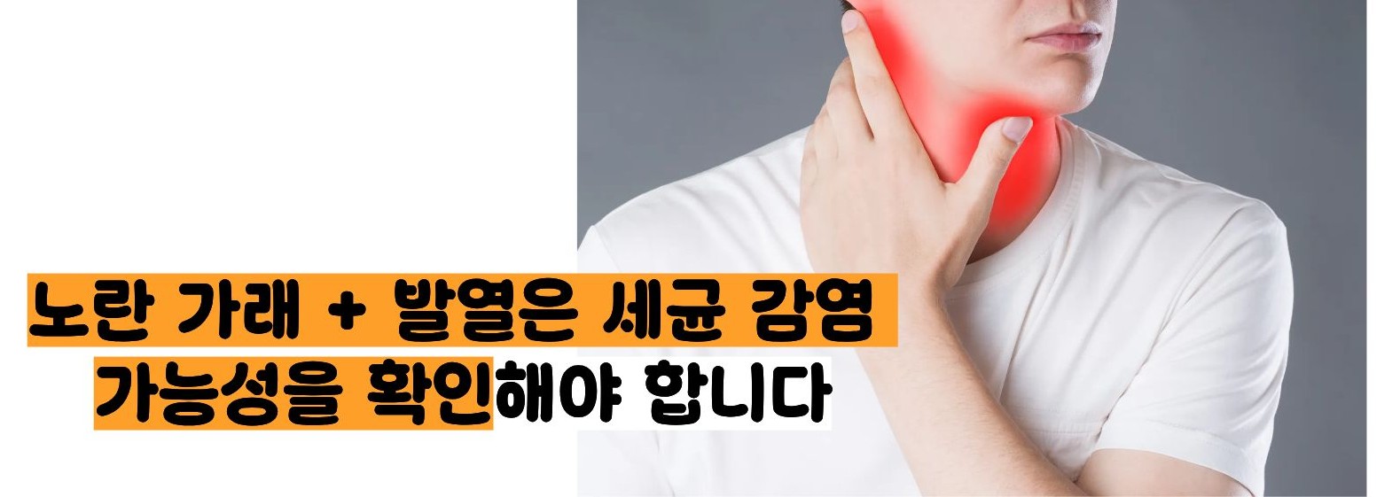 가래가 노란색