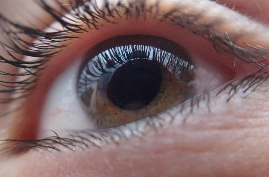 백내장 수술비용 사진