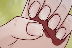 손톱이 잘 부러지는 이유