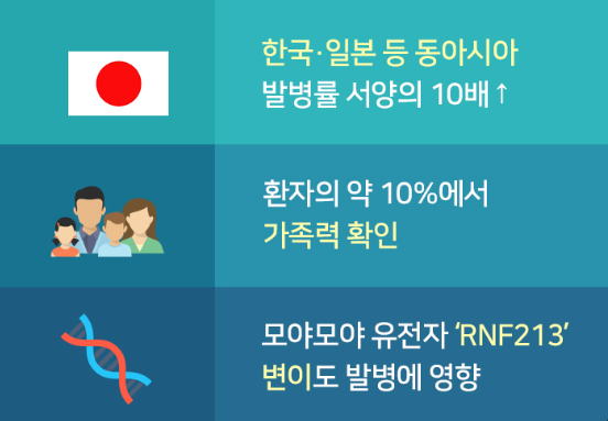 모야모야병