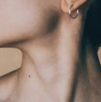 목젖이 부었을 때&amp;#44; 늘어진 느낌과 아플 때 원인과 치료법