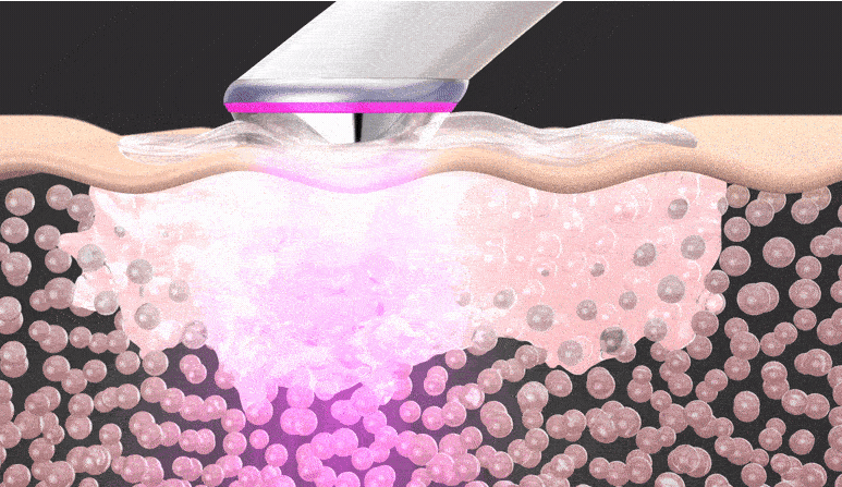 마데카 프라임 탄력 모드