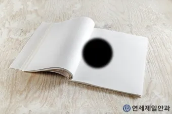 시야에 검은점 시야에 까만점이 보일때 원인과 대처법_10