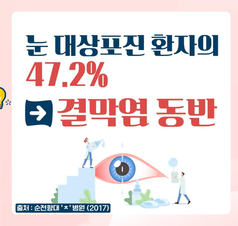 대상포진 초기 증상