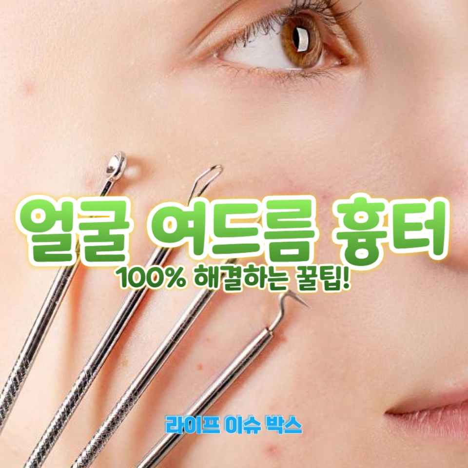 여드름 흉터 없애는 효과적인 방법