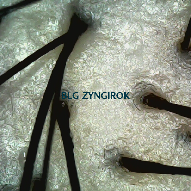 탈모 극복 프로젝트 - 정수리 두피 모습이다.