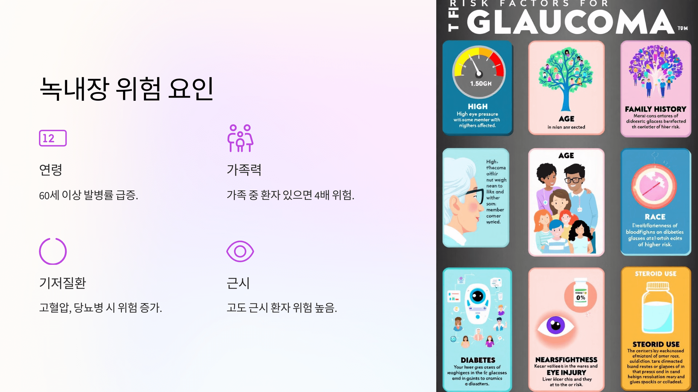 녹내장과 관련된 사진입니다.