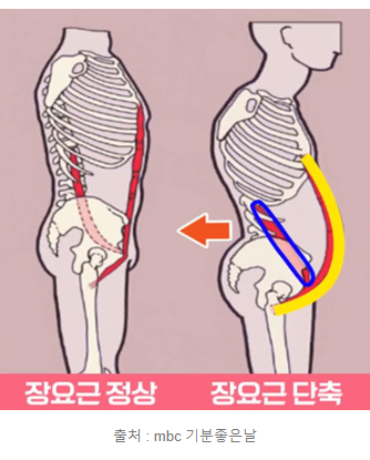 장요근 단축 이미지