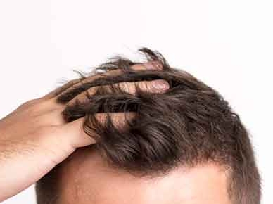 모발-굵어지는법