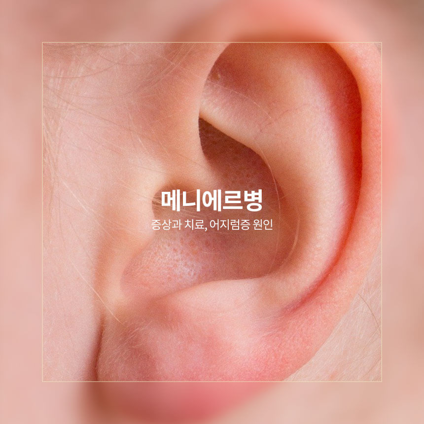 “메니에르병-증상과-치료”
