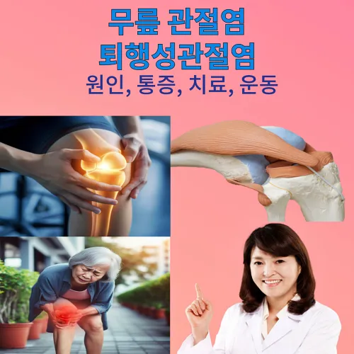 무릎 통증의 주 원인인 퇴행성관절염에 대한 내용을 다루는 포스팅의 썸네일. 무릎의 통증과&#44; 무릎의 연골이 대치되어 보이며 의사선생님이 해결책을 준다는 듯 밝게 웃고 있다.