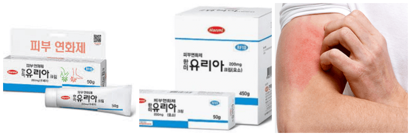 한미 유리아크림, 아토피 피부 사진