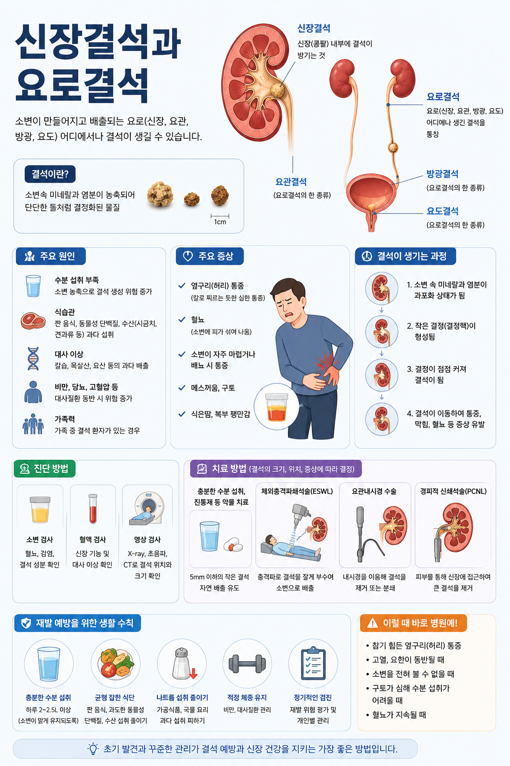 신장 결석 및 요로결석 인포그래픽