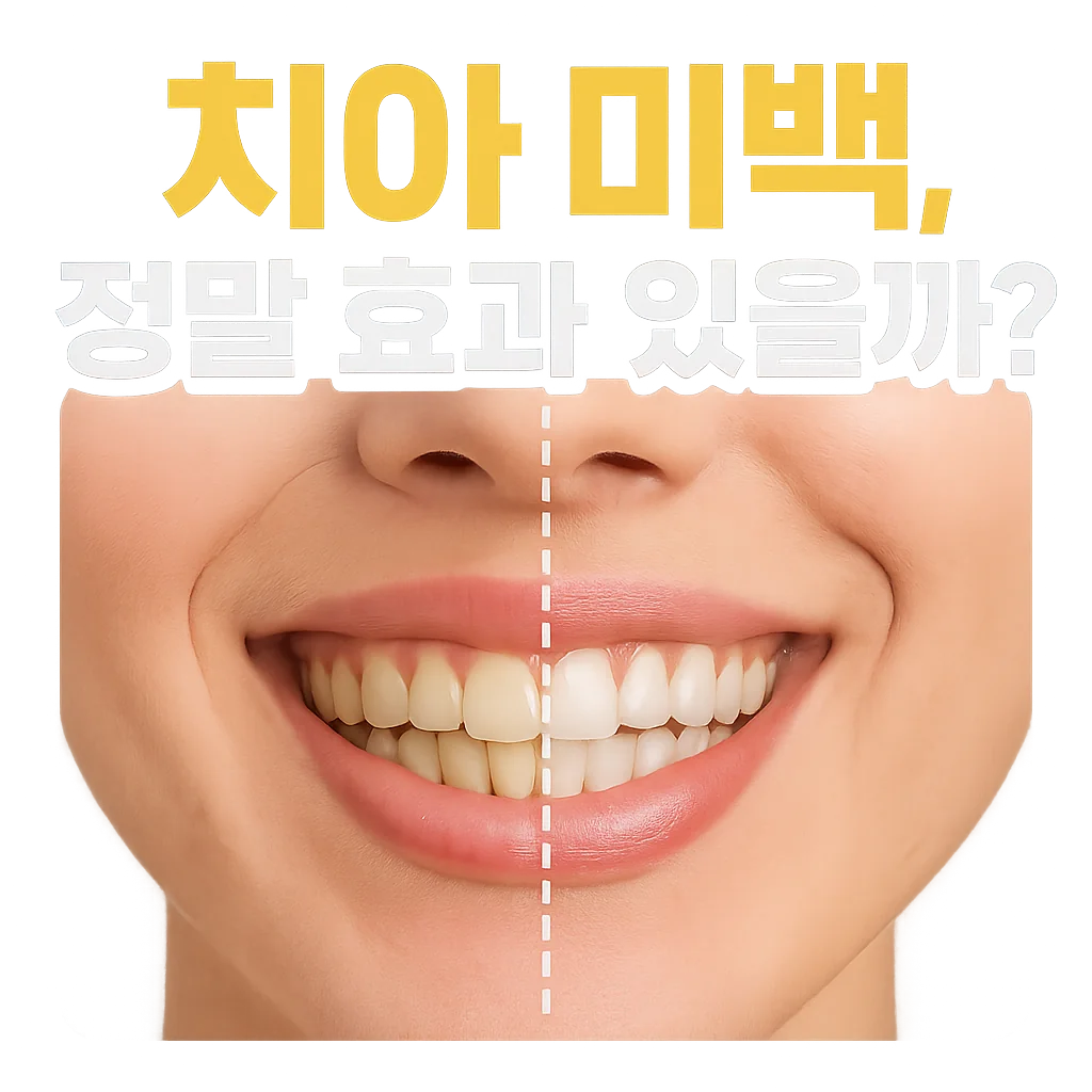 치아 미백, 정말 효과 있을까? 비용부터 부작용까지 완벽 정리