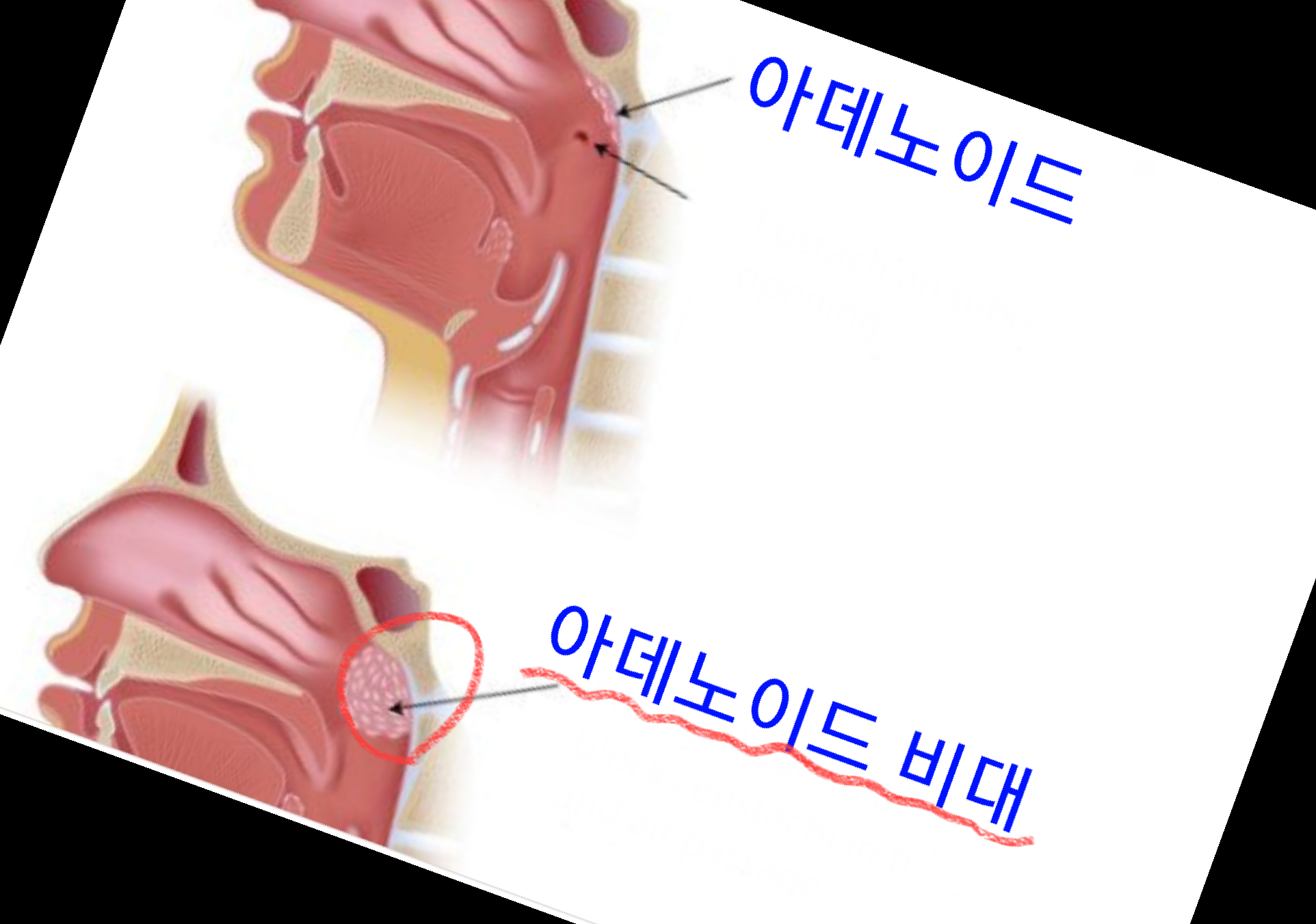 수면영양제 감태잠태 효능 부작용 주의사항