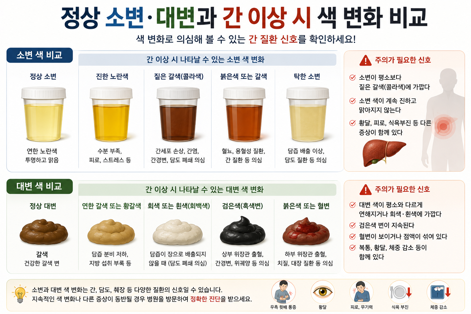 정상 소변과 대변, 간 이상 시 나타날 수 있는 색 변화 비교 이미지