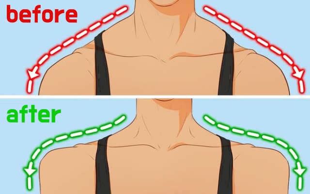 제니 직각어깨 만드는 운동, 승모근 통증 보톡스 담, 승모근 없애는 운동, 다이어트 팁줌 매일꿀정보