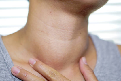 갑상선 기능 항진증 증상, 수치, 검사 총정리 (2024ver)