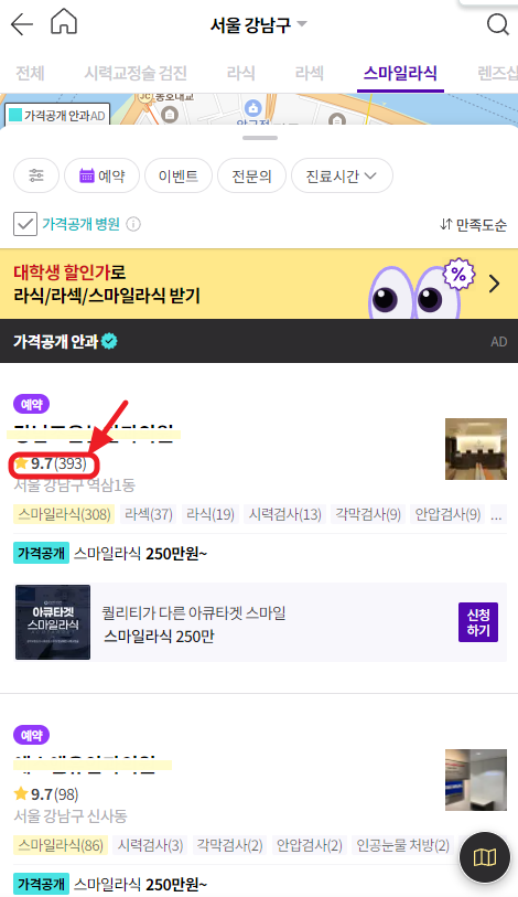 스마일라식-비용