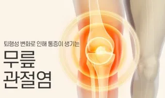 관절염에 좋은 음식 TOP 10_17