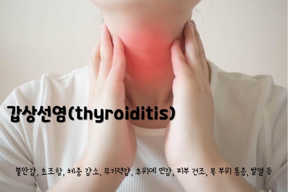 갑상선염(thyroiditis)
갑상선염 주요 증상 : 불안감, 초조함, 체중 감소, 무기력감, 추위에 민감, 피부 건조, 목 부위 통증, 발열 등