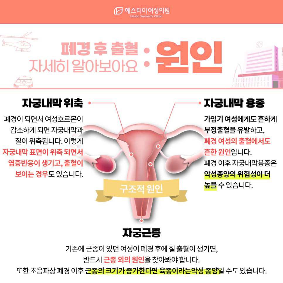 폐경 후 출혈 구조적 원인
