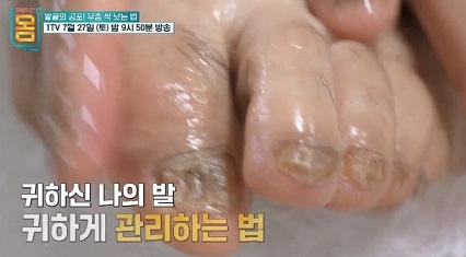 발관리하는방법