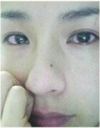 프박