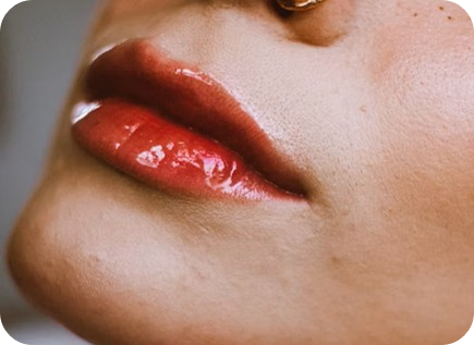 입꼬리 보톡스? 입술 보톡스? 헷갈리는 부위 구분법