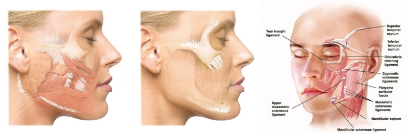 안면거상리프팅