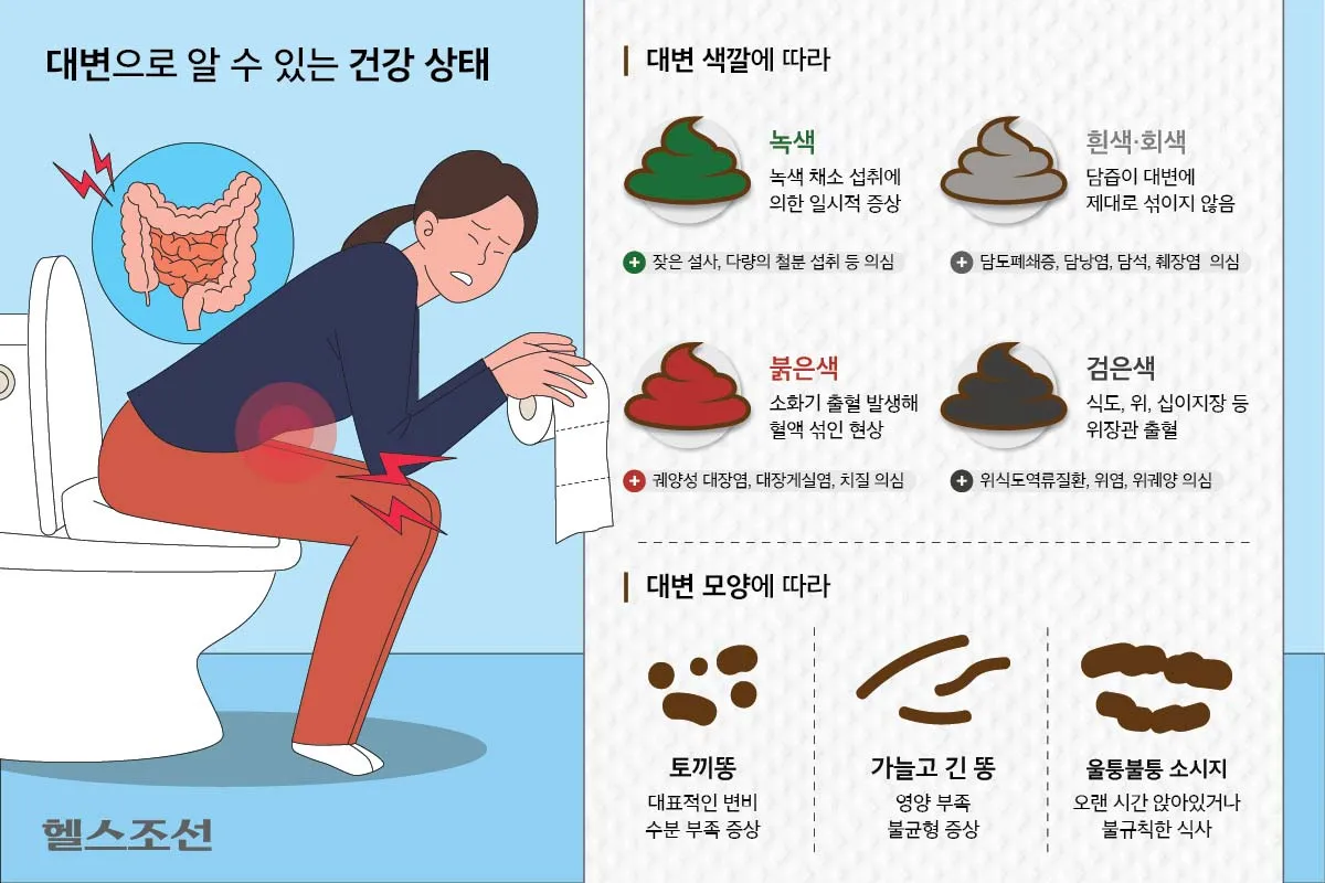 검은 변 원인 위장 출혈 가능성 있는 소화기 질환 정리_3