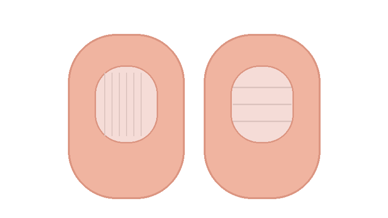 손톱 세로줄&middot;가로줄(보우선) 완전 정리: 노화 신호부터 질환 경고까지 구분하는 법