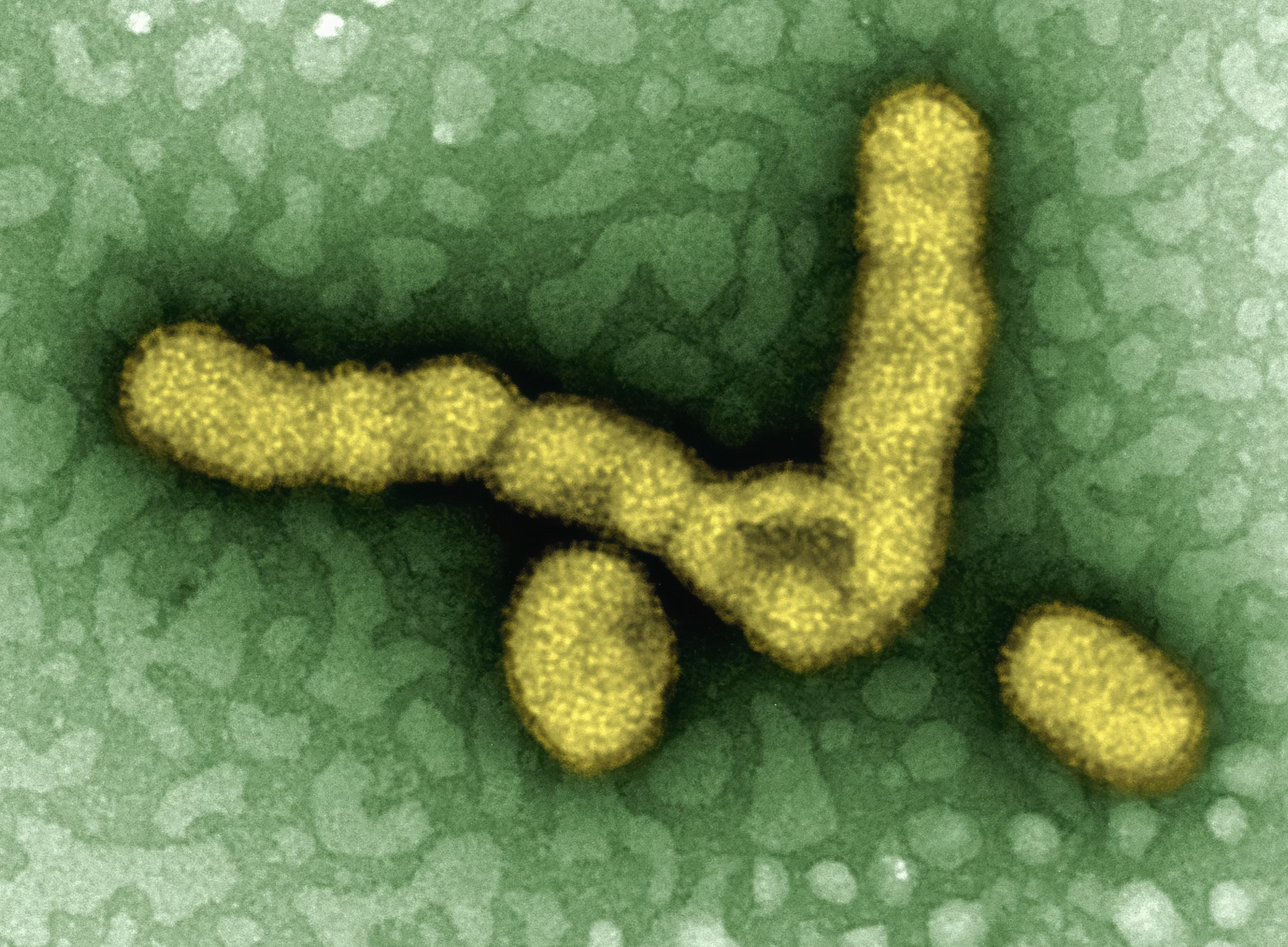 헬리코박터 전염