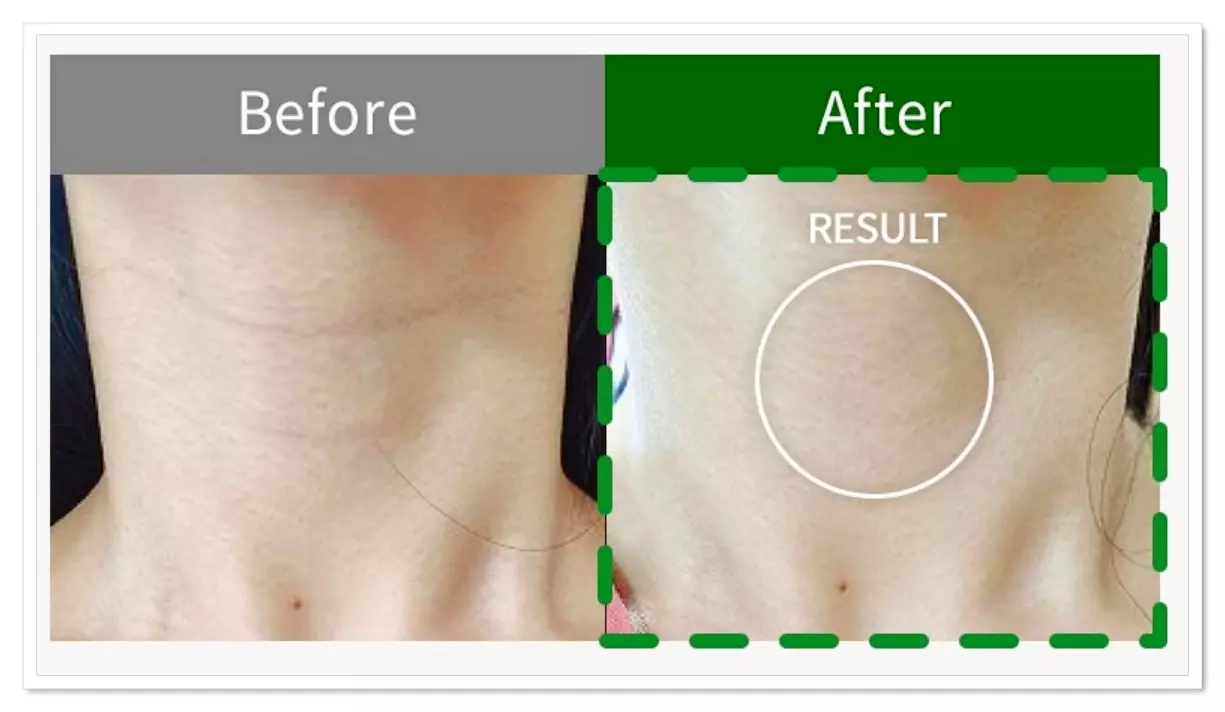 비쏠르 동안크림 목주름 깊이 개선